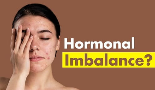 Hormone Imbalance